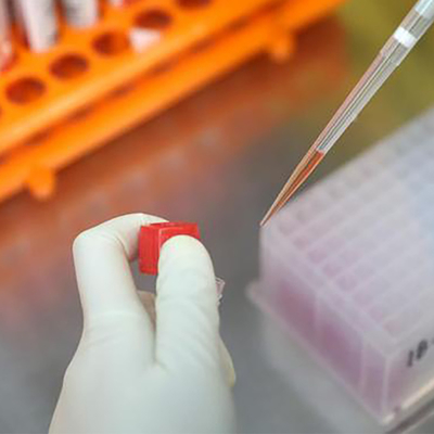 Choroba zakaźna Zestaw testowy PCR w czasie rzeczywistym Monkeypox MPXV Zarejestrowany przez CE 1 test/pudełko